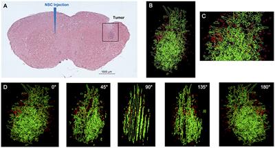 Quantitative Evaluation of Intraventricular Delivery of Therapeutic Neural Stem Cells to Orthotopic Glioma